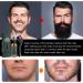 Derma Roller Hair Growth Hair Growth Spray Beard Roller for Growth 540 0.5MM Titanium Needles Beard Roller For Growth For Men Stimulate Beard & Hair Growth/Microneedle Roller(Roller Set) - Buy Online on GoSupps.com
