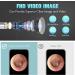 Wireless Ear Otoscope with Camera, Ear Wax Removal Tool, Cleaner & Light - White - Buy Online on GoSupps.com