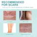 Silicone Scar Removal Tape for Acne, C-Section & Surgery Scars - 2 Rolls, 6-12 Month Supply, 1.6 x 60 Per Roll - Buy Online on GoSupps.com