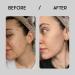 Sane Hyaluronic Acid Serum with Vitamin B5 & PP - Hydrating Face Serum for Healthy Skin - 1.01 fl oz - Buy Online on GoSupps.com