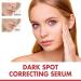 2Pc Niacinamide For Post-Acne Marks Dark Spot Correcting Serum Dark Spot Correcting Glow Serum 10% Niacinamide Niacinamide Serum Facial Care Against Pigmentation Spots And Age Spots - Buy Online on GoSupps.com