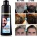 Men Mustache & Beard Dye for Gray Hair to Black Beard Dye for Men Black in 5 Minutes for Easy Application Natural Black Beard Color & Hair Dye Shampoo for Facial Gray Hair Coverage 200ml. - Buy Online on GoSupps.com