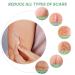 Mebak Clear Silicone Scar Gel Tape Roll (1.6 x 60) - Acne & C-Section Scar Removal Treatment - Reusable Transparent Strips for Keloid Surgery - Scars Treatment Sheets - Buy Online on GoSupps.com