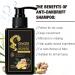 Shampooing au gingembre - Nettoyage limination des pellicules paississant nourrissant le cuir chevelu nettoyage en profondeur et contr le de l'huile aide arr ter la perte pour des cheveux - Buy Online on GoSupps.com