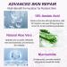 Marianp Hyaluronic Acid Serum & Azelaic Acid 10% for Acne Pigmentation & Rosacea - Vitamin B3 & B5 | Best Skincare Treatment - Buy Online on GoSupps.com