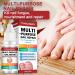 Extra Strong Fungal Nail Treatment - Repair, Strengthen, and Renew Damaged Toenails and Fingernails - Buy Online on GoSupps.com