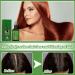 Teegxddy 2 pieces hair growth for men and women accelerates care solution prevents hair loss stimulates beard growth soft universal skin structure 30 ml - Buy Online on GoSupps.com