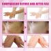 Extra Strong Peeling Oil for Dark Skin | Yellow Exfoliating Solution for Hand & Feet | Chemical Peel for Face | 110ML | Ships Internationally - Buy Online on GoSupps.com