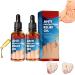 2Pcs German Toenailplus Anti Paronychia Relief Oil, Ingrown Toenail Treatment Pain Relief Oil Repair For Damaged Discolored Thick Nails
