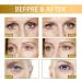 Snail Peptide Energetic Eye Roll-On Firming Eye Cream Eye Cream for Dark Circles and Puffy Eyes Instant-Eye Bag Removal Anti-Wrinkle Eye Cream Under Eye Cream Dark Circles Hydrating &Firming Eye Serum - Buy Online on GoSupps.com