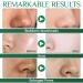 Natural Bamboo Coal Blackhead Remover - 80 Strips for Clogged Pores & Blackhead Removal | Unisex Pore Cleaner - Buy Online on GoSupps.com