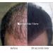 Samson Hair Building Fibers Refill - Compatible with Toppik 100% Undetectable Hair Loss Concealer for Thinning Hair - Black 25g Made in USA - Buy Online on GoSupps.com