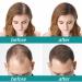Buy The Ordinary Hair Growth Serum for Men & Women | Vegan Multi-Peptide Formula for Thinning Hair & Volume - 60ml - Buy Online on GoSupps.com