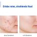 Aknes Cleaning Foam 150ml - Effective Acne Treatment & Skin Care for All Skin Types - Shop Now! - Buy Online on GoSupps.com