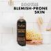 Buy SheaMoisture Soothing Body Wash for Acne Treatment | Paraben Free African Black Soap 13 Fl Oz - International Shipping Available - Buy Online on GoSupps.com