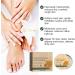 Foot Cream for Cracked Heels and Dry Skin Feet Hard Skin Remover Foot Moisturiser Callus Remover for Feet Nourishes Feet & Hand Foot Care Cream to Improve Elasticity & Smoothen Skin - Buy Online on GoSupps.com