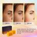 VALITIC Kojic Acid Vitamin C Retinol Soap Bars with Turmeric - Skin Lightening, Dark Spot Treatment, Infused with Collagen, Hyaluronic Acid, Vitamin E (4 Pack) - Buy Online on GoSupps.com