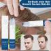 Hair Growth Oil | Volume Roll-On 25ml | Anti-hair loss solution for women and men on the go | For dry damaged and curly hair - Buy Online on GoSupps.com