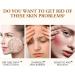 Snail Mucin Moisturiser Snail Mucin Cream Snail Mucin Moisturiser Face Women & Men Anti Aging Face Cream Face Moisturiser for Dry Skin Day & Night Face Cream with Lifting & Anti Wrinkle - Buy Online on GoSupps.com