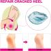 Moisturizing Gel Heel Socks Cracked Gel Heel Socks Toeless Heel Repair Socks for Women (Azure) - Buy Online on GoSupps.com