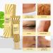 Yuemei Scar Vanishing Cream - Strengthen Skin Repair, Remove Old Scars & Stretch Marks | Suitable for All Skin Types - Buy Online on GoSupps.com