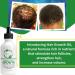 Rosemary & Black Caster Oil Hair Growth Serum | Organic Natural Oils for Breakage & Dry Scalp | Fast Results 2.0 fl oz All Hair Types - Buy Online on GoSupps.com