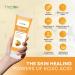 Kojic Acid Soap for Hyperpigmentation - Skin Brightening Papaya Wash - Dark Spot Remover for Acne Scars & Even Skin Tone - Turmeric Cleanser for Glowing Skin - Buy Online on GoSupps.com
