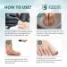 Ingrown Toenail Treatment - Easy Home Removal Kit for Men & Women | Nail Reliever & Softener Tools - Buy Online on GoSupps.com