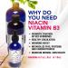 HoneyCombs Vitamin B3 Niacin Supplement Liquid Drops - High Potency Vitamin B3 Liquid Drops for Men & Women - Maintain Digestive System Skin Tongue Energy and More - Vegan Niacin Drop (8 Fl oz) - Buy Online on GoSupps.com