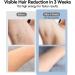 Lescolton Sapphire IPL Hair Removal - Painless ICE Cooling Tech 3 Replacement Filters for Face & Body | Home Use for Men & Women - Buy Online on GoSupps.com