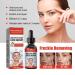 Salicylic Acid Serum for Acne & Blackheads - Refreshing Exfoliating Moisturizer for All Skin Types - Buy Online on GoSupps.com