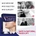 Invisible Waterproof Face Lift Tape - 40 Pcs Instant Lifting Stickers for Face & Neck - High Elasticity, Makeup Tools for Wrinkle Reduction & Facial Line Improvement - Buy Online on GoSupps.com