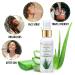 Aloe Vera Spray for Hair Dreads & Locs + Eucalyptus Face Mist | Hydrating & Refreshing 2oz - Buy Online on GoSupps.com