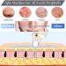 USB Rechargeable Blackhead Remover Pore Vacuum Kit - 3 Suction Power - Facial Pore Cleaner for Men & Women (White) - Buy Online on GoSupps.com