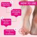 CARNATION Round Corn Relief Pads. Medical Grade Felt Ideal for Toes Skin Friendly Adhesive. Multipack 3 Packs x 12 Round Pads 36 Pads in Total - Buy Online on GoSupps.com