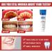 Smile Doctor SP-4 Probiotic Whitening Toothpaste - Ultra Whitening Fresh Breath & Teeth Whitener (3PCs) - International Shipping Available - Buy Online on GoSupps.com