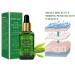 Tea Tree Acne Treatment Serum - Clear Severe Acne Breakouts & Repair Skin - 40ml (1.41fl oz) - Buy Online on GoSupps.com