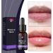  Generisch Moisturizing lip oil - Moisturizing oil for dry lips - Glossy treatment for women and girls - Buy Online on GoSupps.com