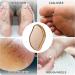 Nano Glass Foot File - Ultimate Foot Shaver for Hard Skin Dead Skin Remover for Feet Dry Skin Remover Feet Hard Skin Remover Foot Grater Hard Skin Remover Professional Pedicure Tool - Buy Online on GoSupps.com