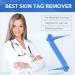 Skin Tag & Mole Remover Kit - Safe & Painless Removal for Small to Large Skin Tags (2mm-8mm) - Buy Online on GoSupps.com
