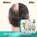 Shampoo Conditioner & Serum Set | Fermented Rice Water & Biotin | Hair Growth Repair Kit | Sulfate Free Vegan All Hair Types - Buy Online on GoSupps.com