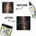 Chebe Hair Growth Oil & Butter - Deep Moisturization for All Hair Types | 8.8oz | Men & Women - Buy Online on GoSupps.com
