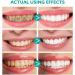 Teethaid Mouthwash - 2PC Whitening Foam Toothpaste for Natural Oral Care | 100ml & 30g Pack - Buy Online on GoSupps.com
