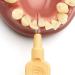 Tepe Interdental Brushes X-Soft - Light Orange 0.45 mm (Pack of 6) | Best for Oral Hygiene & Dental Care | Shop Internationally - Buy Online on GoSupps.com