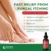 Fungal Nail Treatment 30ml | Effective Antifungal Formula for Toes and Hand Nails - Buy Online on GoSupps.com