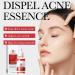 Friut Acid Face Serum for Acne Mark Salicylic Acid Anti Wrinkle Serum Fade Ance Mark & Shrink Pore Face Serum Hyaluronic Acid Acne Repair Serum for Sensitive Skin Smoothing Hyaluronic Serum-30ml - Buy Online on GoSupps.com