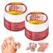 2PCS Urigone Healing Ointment Bunion Cream Bunion Toe Stiffness Relief Cream Ointment Toe Joint Valgus Corrector Cream