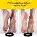 PedEgg Jumbo - As Seen On TV | Effortlessly Remove Calluses & Dry Skin | Easy Reach Handle & 300% More Microfiles for Smooth Feet - Buy Online on GoSupps.com
