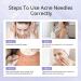 ANLAN Blackhead Remover Tool Kit for Acne and Blemish Removal - Buy Online on GoSupps.com