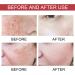 2Pc Niacinamide For Post-Acne Marks Dark Spot Correcting Serum Dark Spot Correcting Glow Serum 10% Niacinamide Niacinamide Serum Facial Care Against Pigmentation Spots And Age Spots - Buy Online on GoSupps.com